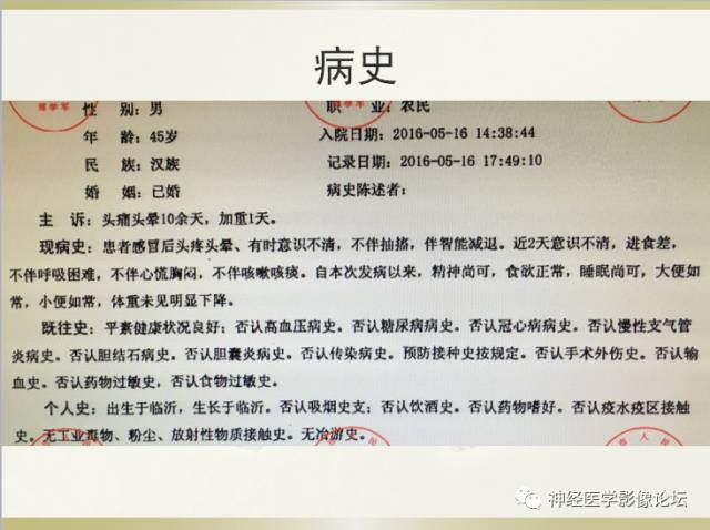 【病例】小脑脓肿一例 CT及MR