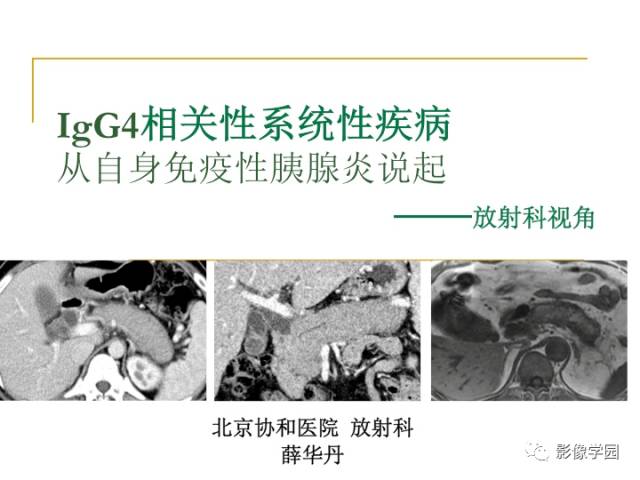 【PPT】IgG4相关性系统性疾病——从自身免疫性胰腺炎说起