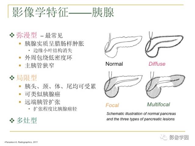 【PPT】IgG4相关性系统性疾病——从自身免疫性胰腺炎说起