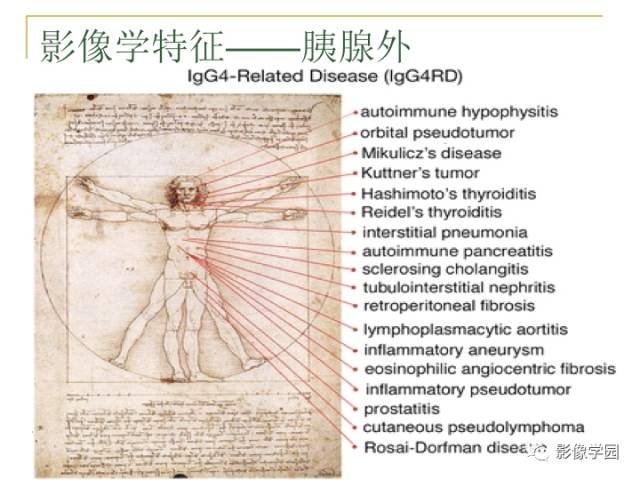 【PPT】IgG4相关性系统性疾病——从自身免疫性胰腺炎说起