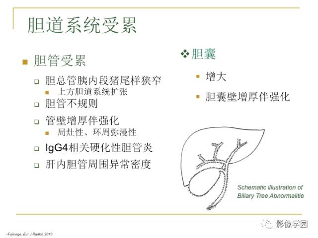 【PPT】IgG4相关性系统性疾病——从自身免疫性胰腺炎说起