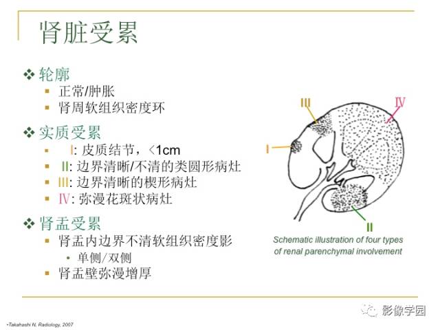【PPT】IgG4相关性系统性疾病——从自身免疫性胰腺炎说起