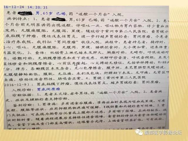 【病例】胃神经鞘瘤1例CT影像表现