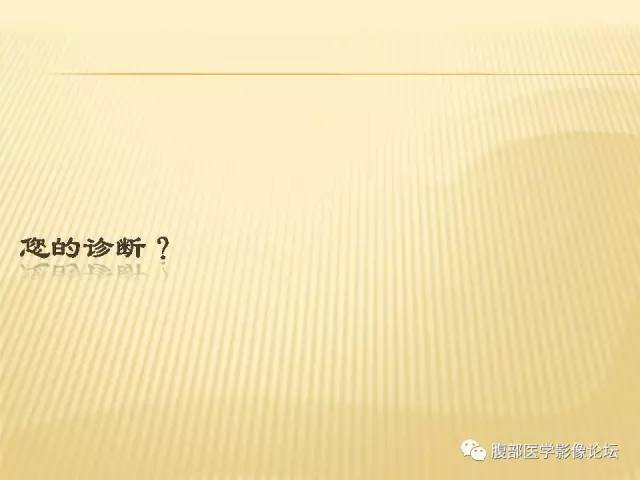 【病例】胃神经鞘瘤1例CT影像表现 【病例】胃神经鞘瘤1例CT影像表现