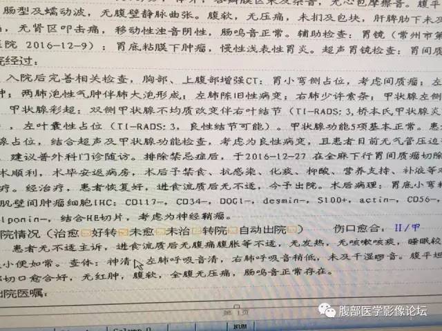 【病例】胃神经鞘瘤1例CT影像表现 【病例】胃神经鞘瘤1例CT影像表现