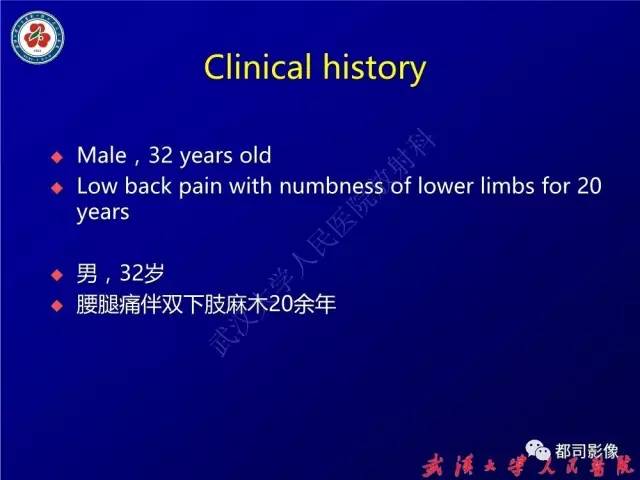 【病例】腰骶段椎管巨大神经鞘瘤1例MR影像诊断