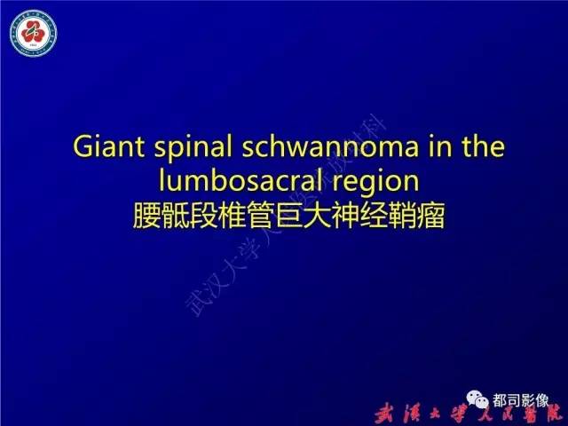 【病例】腰骶段椎管巨大神经鞘瘤1例MR影像诊断