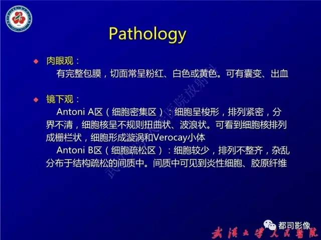 【病例】腰骶段椎管巨大神经鞘瘤1例MR影像诊断
