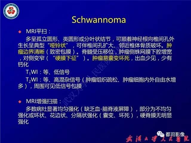 【病例】腰骶段椎管巨大神经鞘瘤1例MR影像诊断