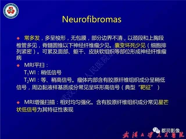 【病例】腰骶段椎管巨大神经鞘瘤1例MR影像诊断