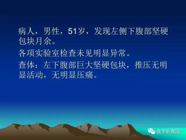 【病例】腰椎软骨肉瘤1例CT及MR