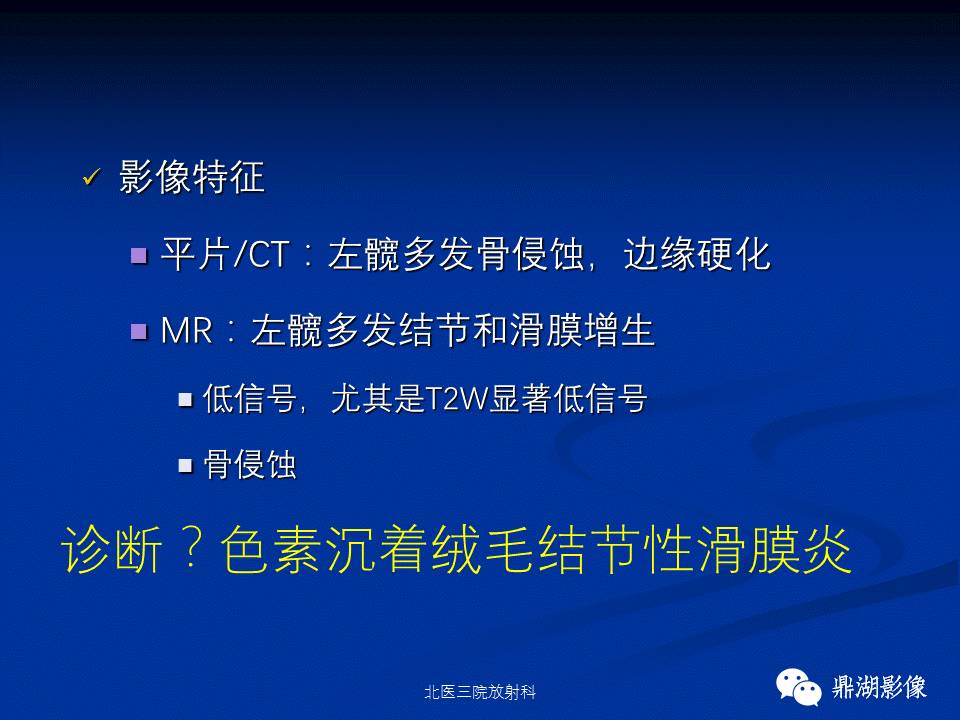 髋部疼痛：(影像)鉴别诊断