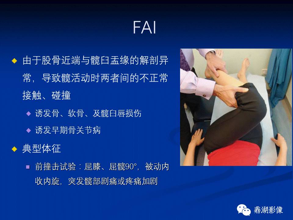 髋部疼痛：(影像)鉴别诊断