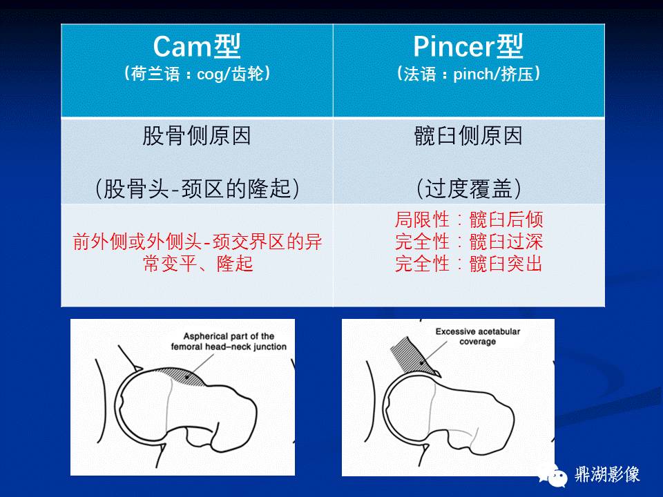 髋部疼痛：(影像)鉴别诊断