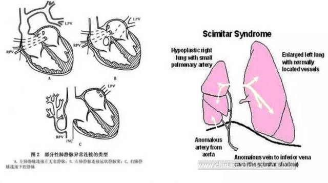胸部影像学征象——肺部 胸部影像学征象——肺部