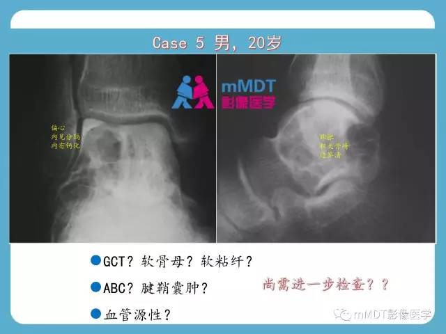 【PPT】跗骨病变影像分析思路(续)