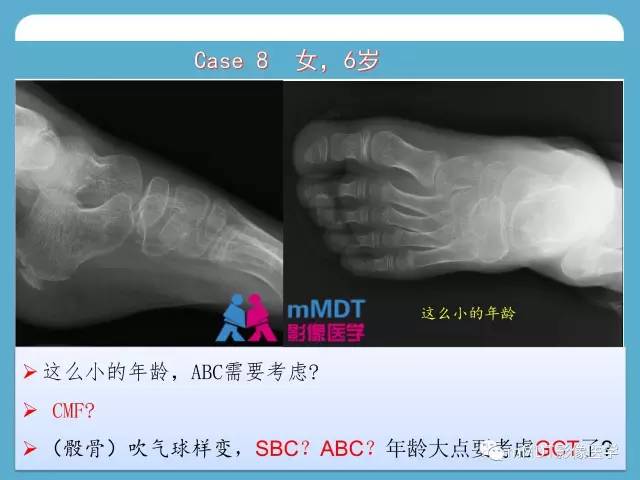 【PPT】跗骨病变影像分析思路(续)