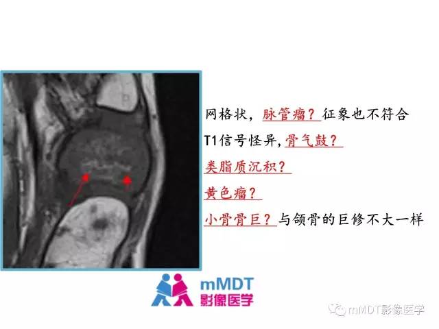 【PPT】跗骨病变影像分析思路(续)