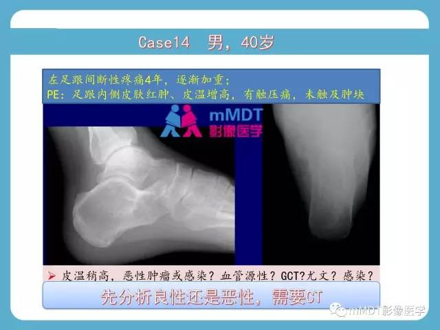 【PPT】跗骨病变影像分析思路(续)