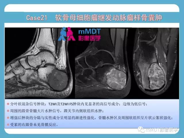 【PPT】跗骨病变影像分析思路(续)