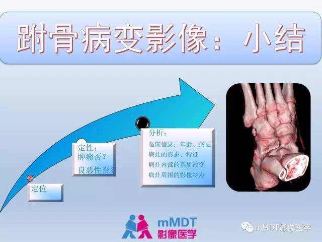 【PPT】跗骨病变影像分析思路(续)