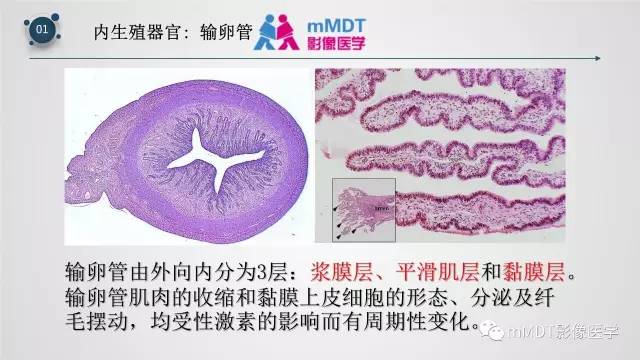 【PPT】子宫附件影像解剖