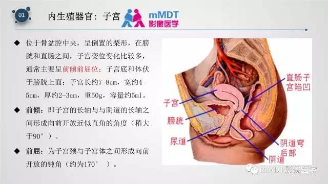 【PPT】子宫附件影像解剖
