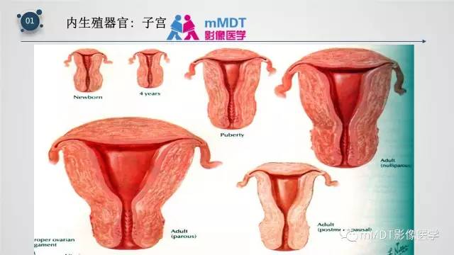 【PPT】子宫附件影像解剖
