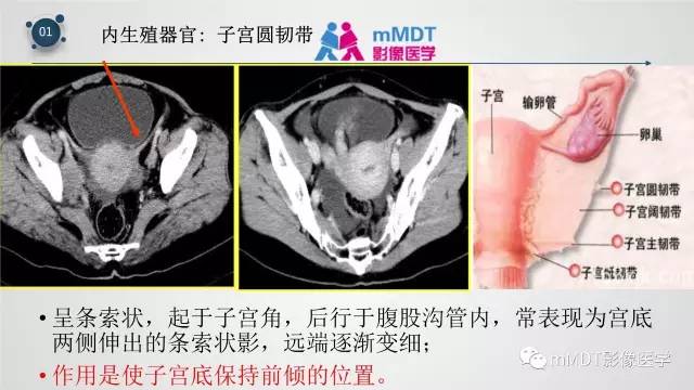 【PPT】子宫附件影像解剖