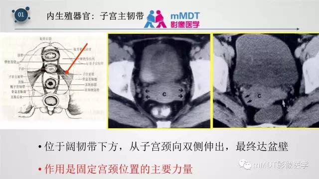 【PPT】子宫附件影像解剖