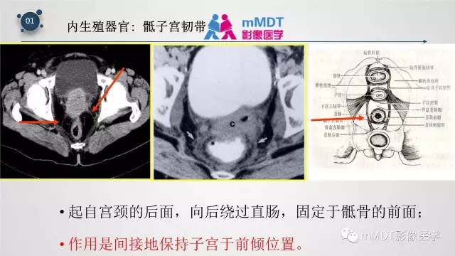 【PPT】子宫附件影像解剖