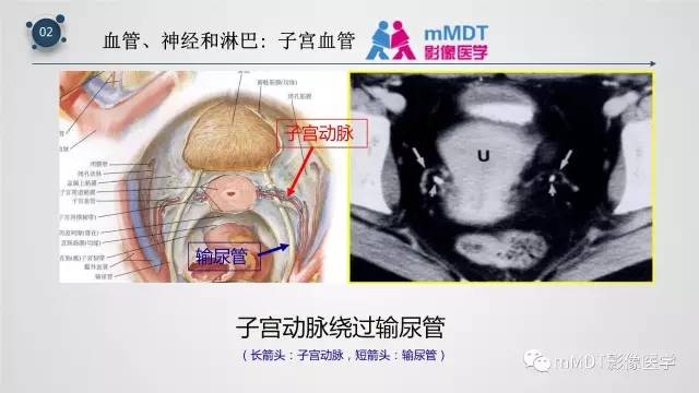 【PPT】子宫附件影像解剖
