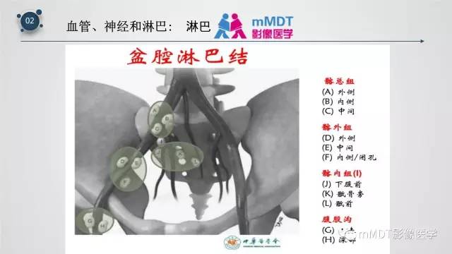【PPT】子宫附件影像解剖