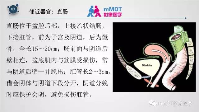 【PPT】子宫附件影像解剖
