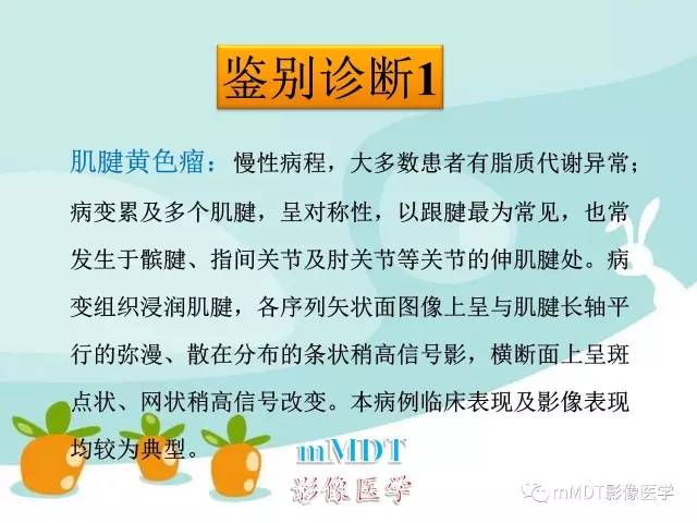 【PPT】脑腱黄瘤病