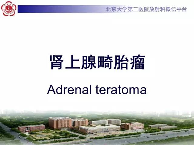 【病例】肾上腺畸胎瘤1例CT影像表现