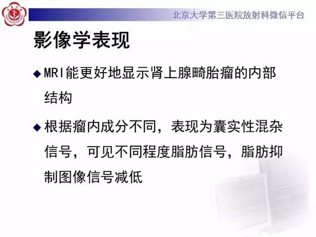 【病例】肾上腺畸胎瘤1例CT影像表现