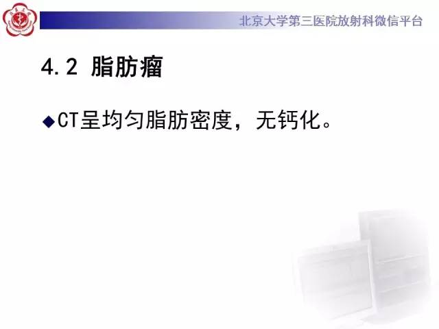 【病例】肾上腺畸胎瘤1例CT影像表现