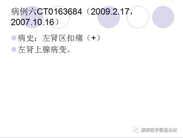 【病例】肾上腺病例6例CT 【病例】肾上腺病例6例CT