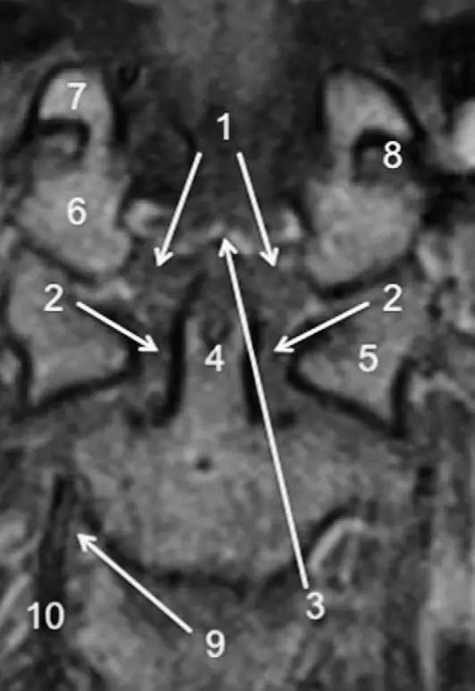 MRI 下脊椎基本解剖集锦——颈椎 MRI 下脊椎基本解剖集锦——颈椎