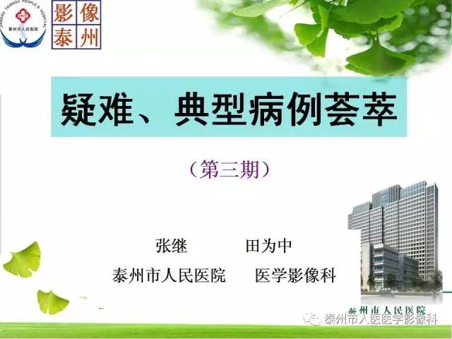 【病例】脊索瘤2例影像诊断与鉴别诊断