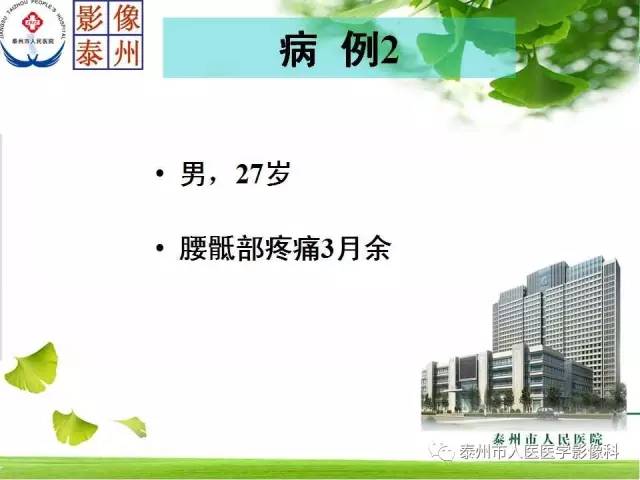 【病例】脊索瘤2例影像诊断与鉴别诊断
