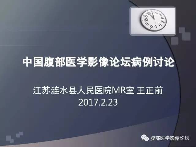 【病例】卵巢纤维卵泡膜瘤1例MR 【病例】卵巢纤维卵泡膜瘤1例MR