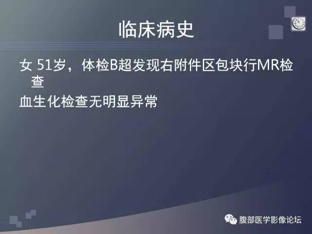 【病例】卵巢纤维卵泡膜瘤1例MR