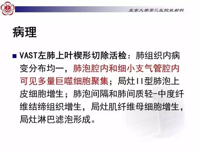 【病例】特发性间质性肺炎2例影像表现
