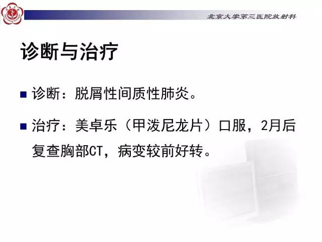 【病例】特发性间质性肺炎2例影像表现