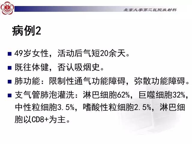 【病例】特发性间质性肺炎2例影像表现