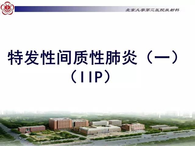 【病例】特发性间质性肺炎2例影像表现