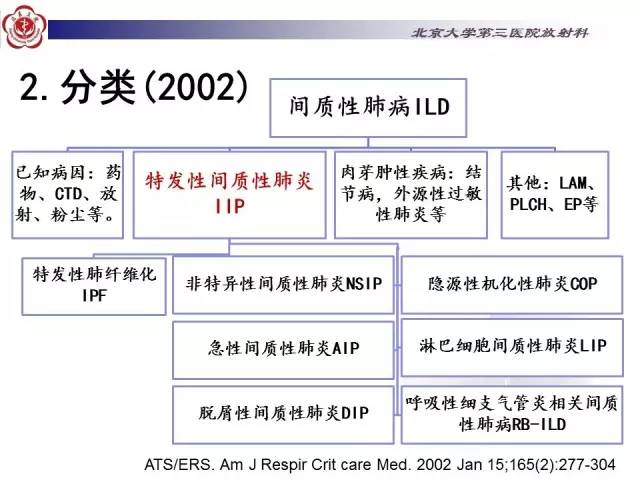 【病例】特发性间质性肺炎2例影像表现