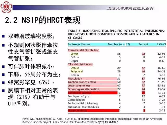 【病例】特发性间质性肺炎2例影像表现